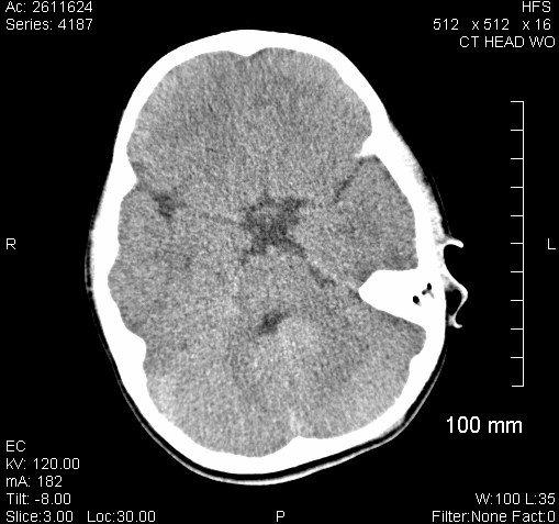 Medical Negligence 101