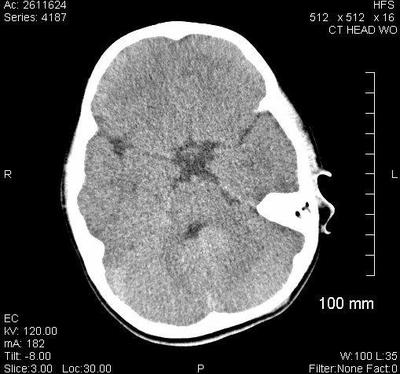 Medical Negligence 101